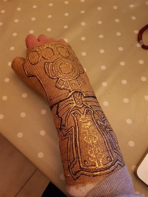 After Breaking My Wrist, I Turned My Plain Cast Into Thanos‘ Infinity Gauntlet | Bored Panda