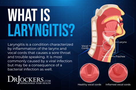 Laryngitis: Symptoms and Natural Support Strategies