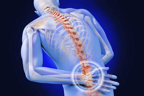 Lumbar Fusion: What You Need To Know About This Back Surgery