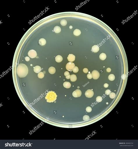 Colonies Of Bacteria From Sea Water On A Petri Dish (Agar Plate ...