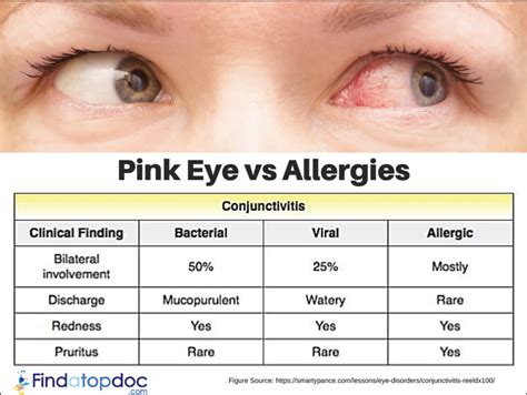 What Are the Causes of Conjunctivitis?