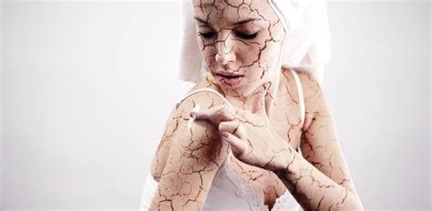 The best ways to treat skin dryness | ReliableRxPharmacy Blog, Health Blog