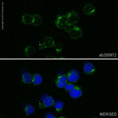 Alexa Fluor® 488 Anti-S100A9 antibody [EPR3555] (ab200972) | Abcam