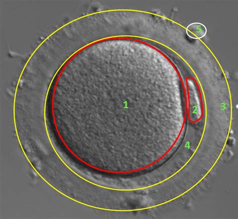 Image of oocyte in stage MII (1—Cytoplasm (CPM), 2—First polar body... | Download Scientific Diagram