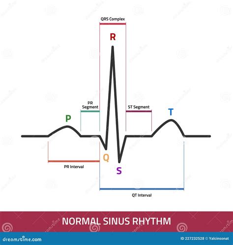 Heartbeat Normal ECG Graph Stock Photo | CartoonDealer.com #71108214