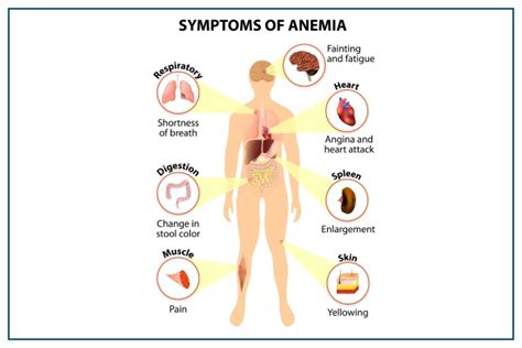 Risk Factors And Precautions For Anemia - Ask The Nurse Expert