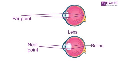 Power of Accommodation of the Eye - Definition, Importance, Video, and FAQs