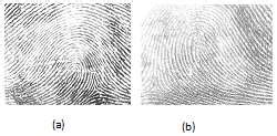 Loop Pattern (a) Radial Loop when found in right hand (Ulnar if in left ...