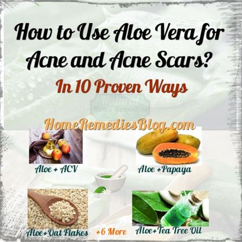 How to Use Aloe Vera for Treating Acne Effectively - Home Remedies Blog