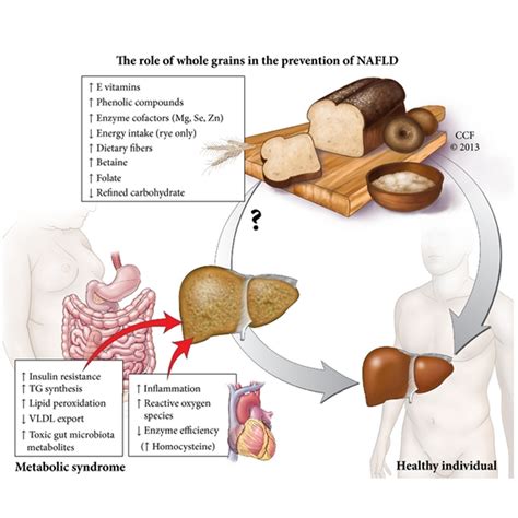 ‘Tis the Season for Liver Damage… | crossoversa.co.za