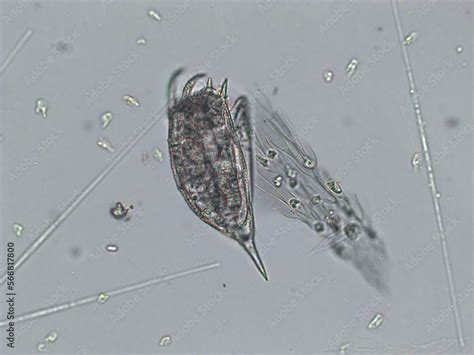 Freshwater aquatic zooplankton and algae under microscope view Stock ...