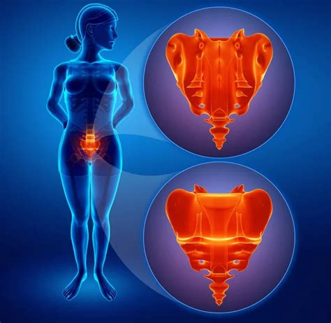 3d illustration of sacrum bone pain — Stock Photo © pixdesign123 #145341377