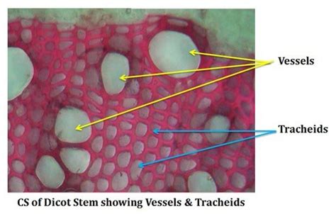 Parts of Xylem | EasyBiologyClass