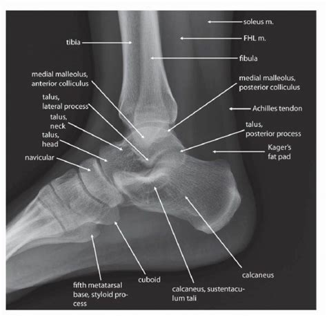 Foot Xray Anatomy - Anatomical Charts & Posters