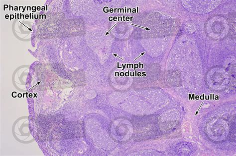 Man. Adenoid. Transverse section. 32X - Man - Mammals - Lymphatic ...