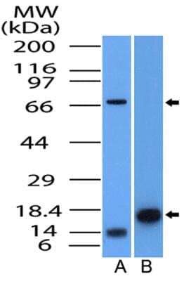 Paving Stone Retinal Degeneration: Disease Bioinformatics: Novus Biologicals