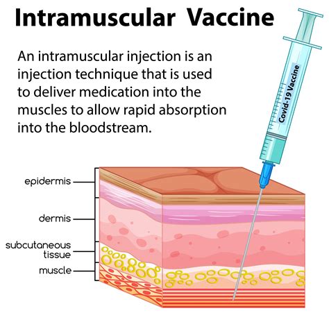 Intramuscular Injection