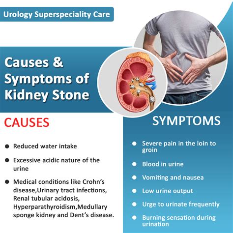 Symptoms Of Kidney Stones Men