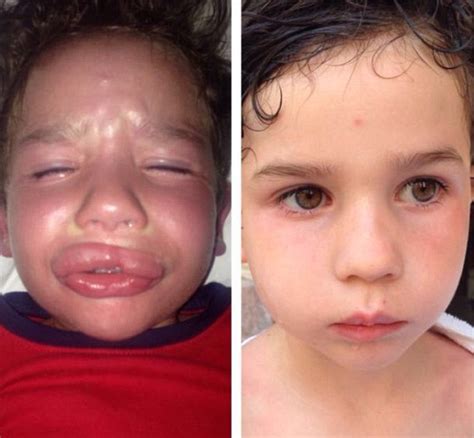 Mother and son forced off Emirates plane over nut allergy | Daily Mail Online