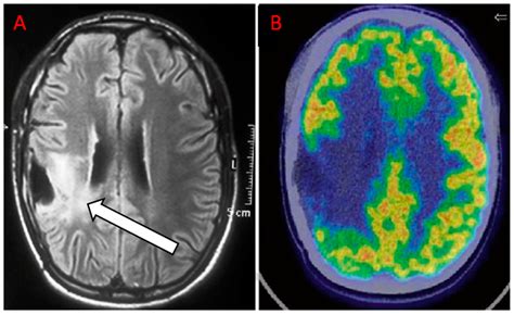 Pet Brain Scan