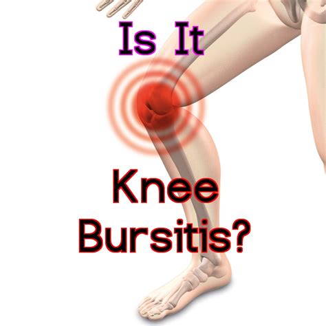 Knee Bursitis Symptoms and Best Treatment Options | HealDove