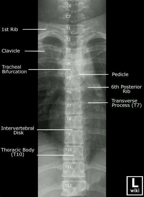 Pin by Stephanie Otz on - Radiography Anatomy - | Pinterest