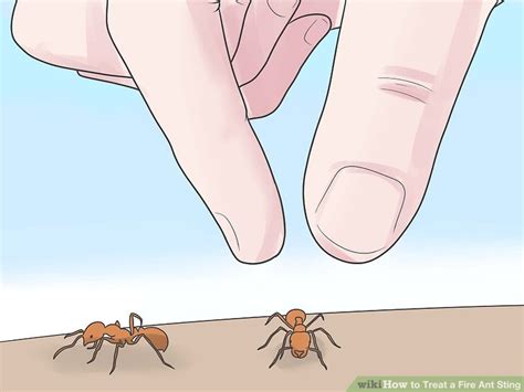 How to Treat a Fire Ant Sting: 14 Steps (with Pictures) - wikiHow