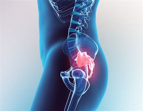 Tailbone Pain Treatment For Coccydynia In Malaysia