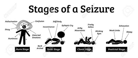 Stages and phases of a seizure. Illustrations depicts the phases when a person get a seizure ...