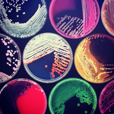 Bacterial Growth On Agar Plates