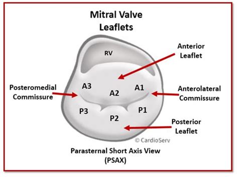 Mitral Valve Anatomy: Name 5 Components! Cardioserv