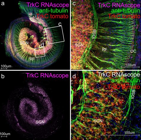 Fluorescence In Situ Hybridization