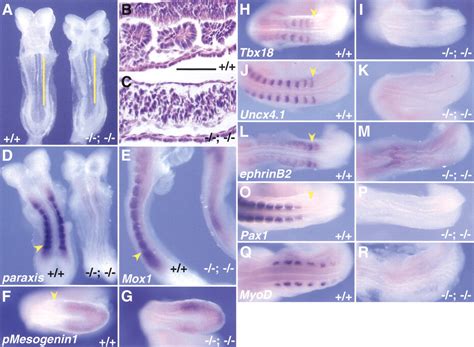 The murine winged helix transcription factors, Foxc1 and Foxc2, are both required for ...