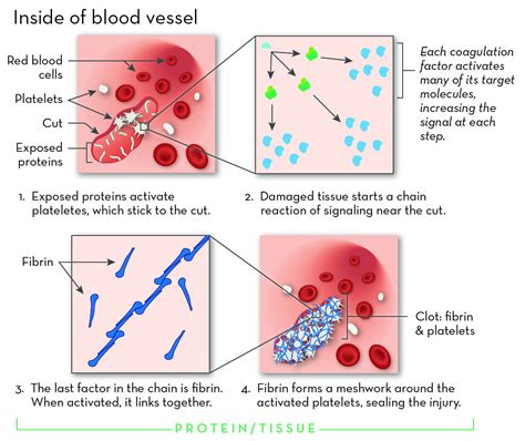 Different Types Of Hemophilia Diagram