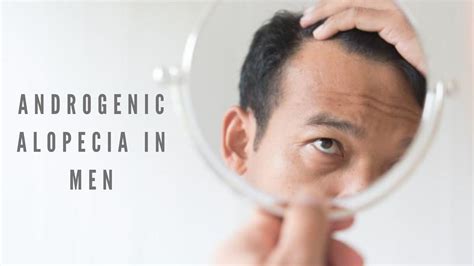 Androgenic Alopecia in Men | Symptoms | Causes | Treatment