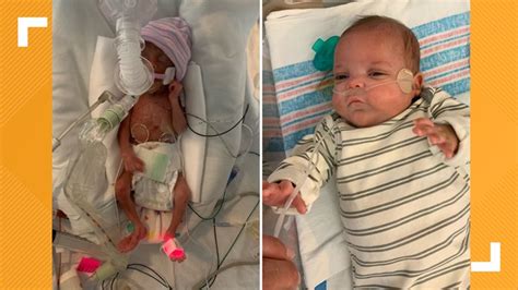 'Miracle baby' born at 22 weeks breaks hospital record | wwltv.com