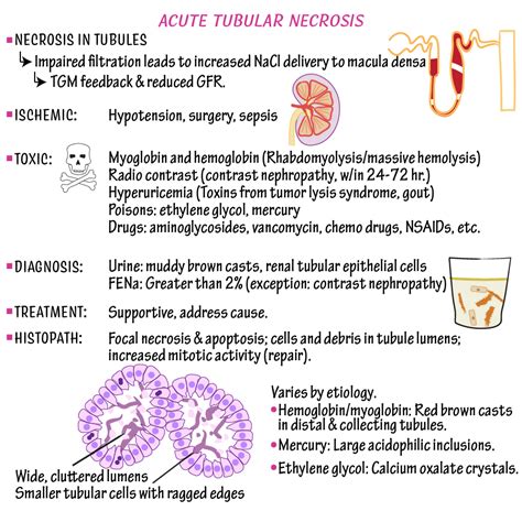 Pathology Glossary: Acute Tubular Necrosis & Interstitial Nephritis | Draw It to Know It