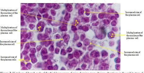 Plasma Cells Histology