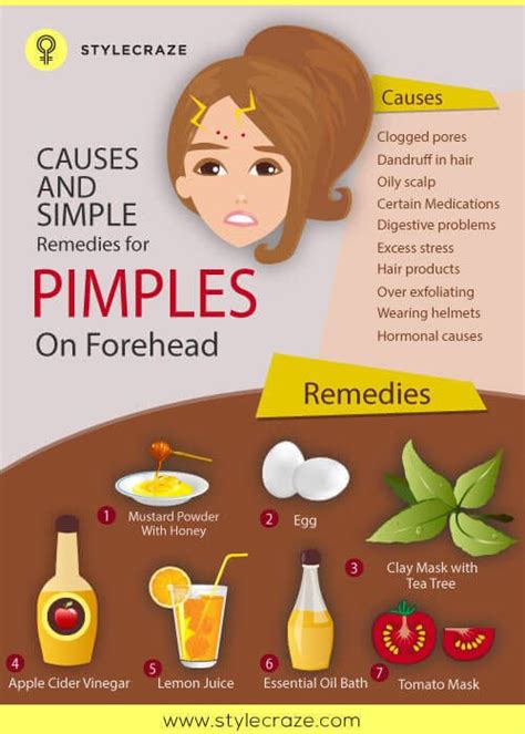 10 Causes And Simple Remedies For Pimples On Forehead | Forehead acne, Pimples remedies, Pimples ...