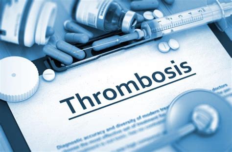 Blood Clot Treatment - Blood Clots