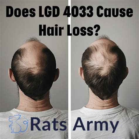 Before and After Cycle: Does LGD 4033 Cause Hair Loss?