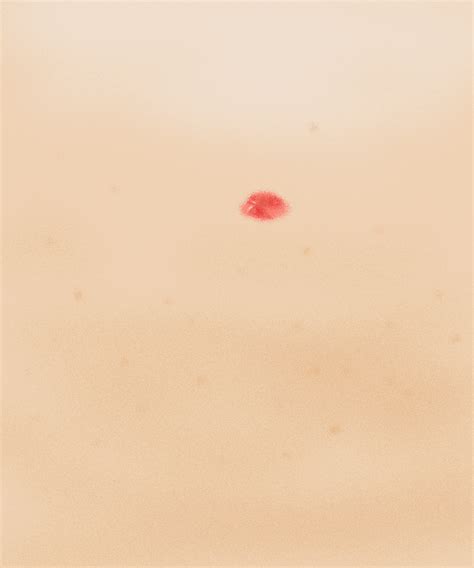 Partially tone Conquer red blood spots on body while flow cotton