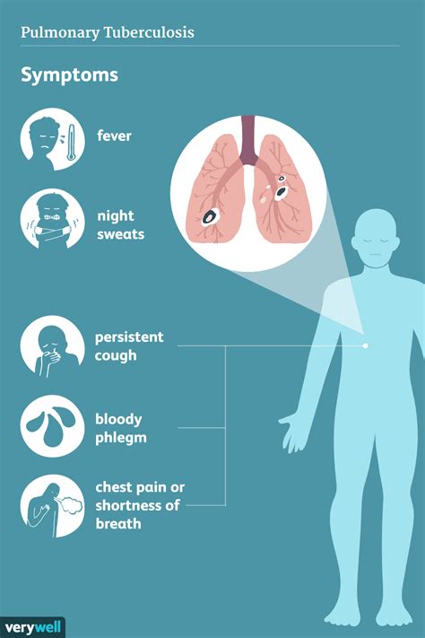 How Tuberculosis (TB) Is Treated