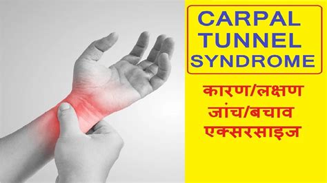 Carpal tunnel syndrome in hindi || carpal tunnel syndrome kya hota hai ...