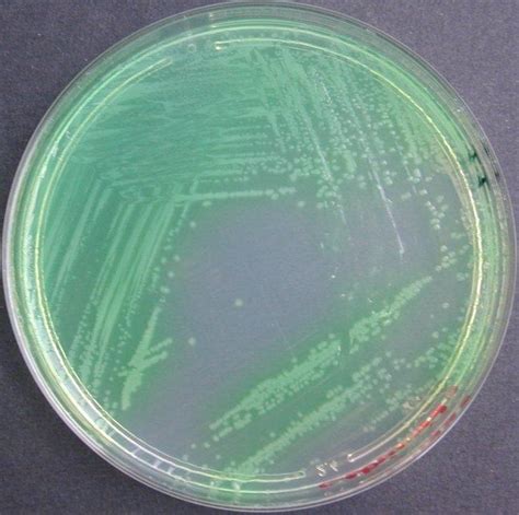 Show Pseudomonas aregenosa colony on cetrimide agar. | Download Scientific Diagram