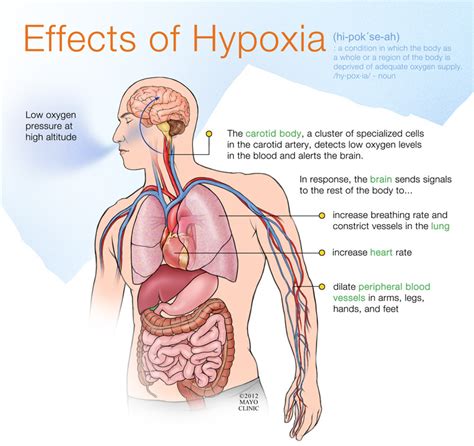 What are the common causes of hypoxia? – First aid for free