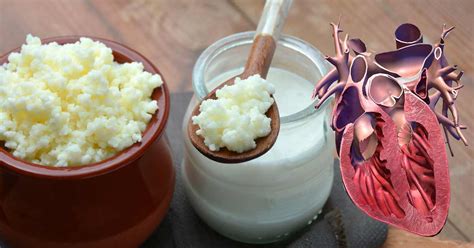 Fermented Dairy Protects Your Heart