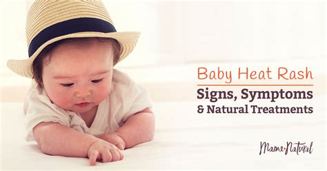 Baby Heat Rash: Signs, Symptoms & Natural Treatments