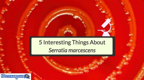 5 Interesting Things About Serratia marcescens