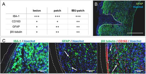 Immunohistochemical analysis of tissues. a Semi-quantitative analysis... | Download Scientific ...